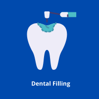 Dental Filling