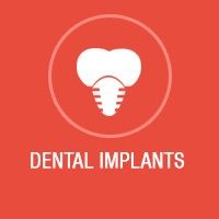 Dental Implant Bangalore